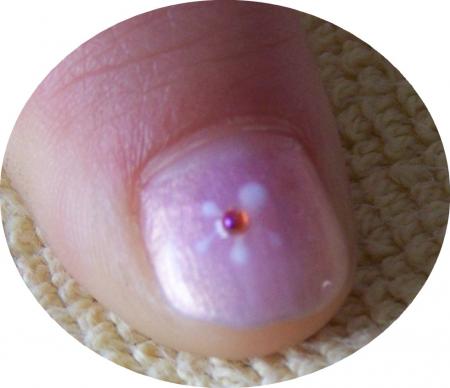 Ongles enfants