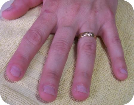Pose Tips sur ongles rongés